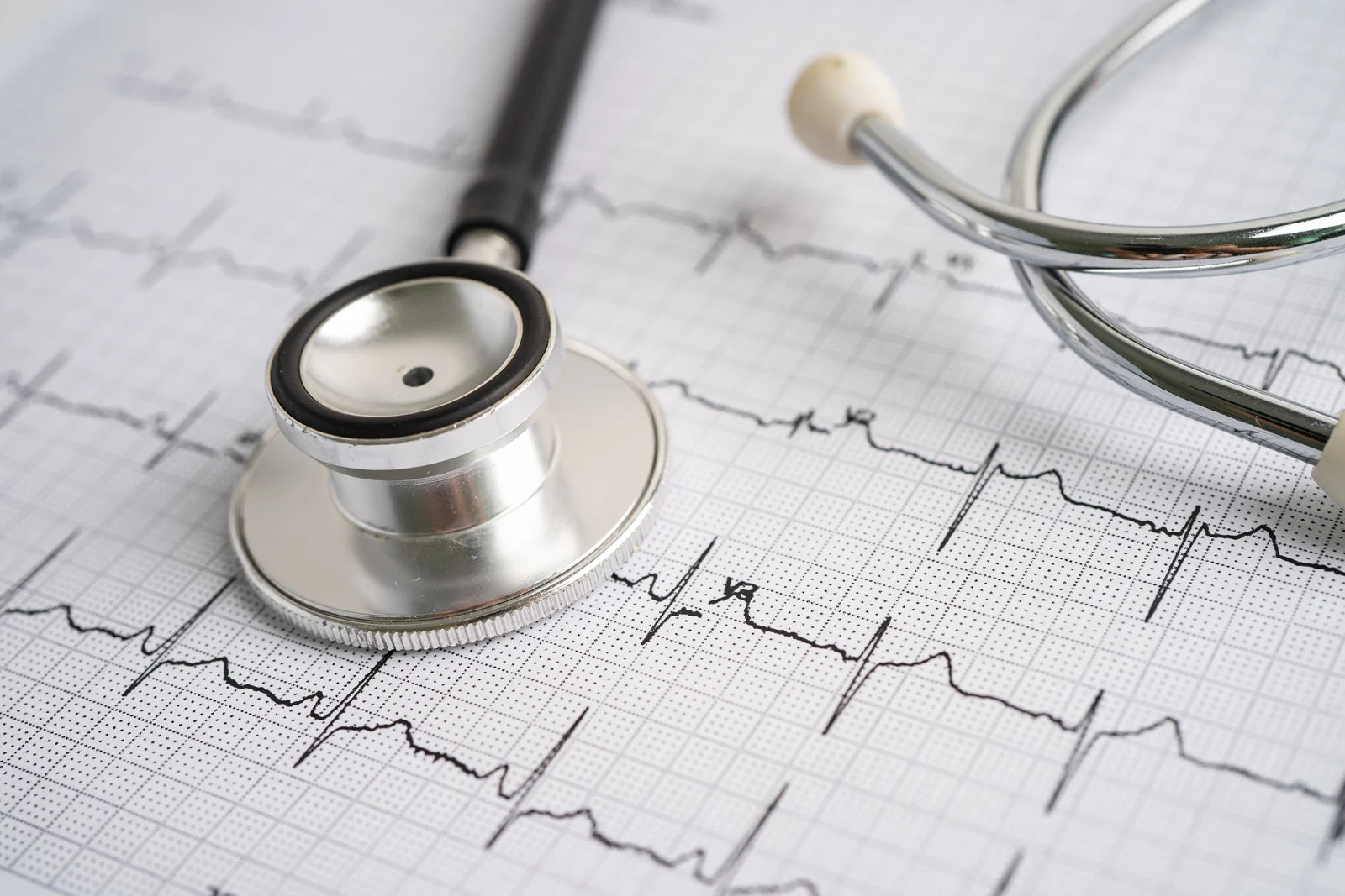 ecg